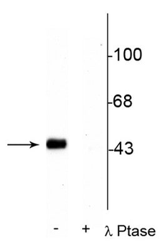 CREB (Ser133) Antibody