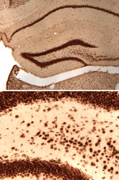 CREB (Ser133) Antibody