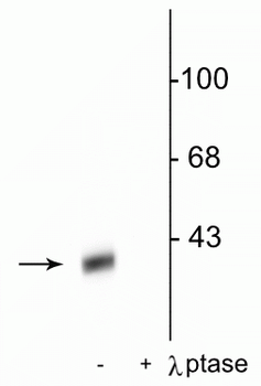 DARPP-32 (Thr34) Antibody