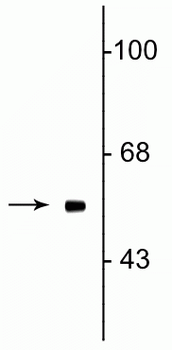 FTO (Fat mass and obesity related protein) Antibody
