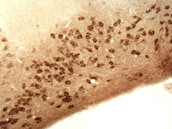 GABAA Receptor α1 Antibody
