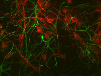 Glial Fibrillary Acidic Proetin (GFAP) Antibody