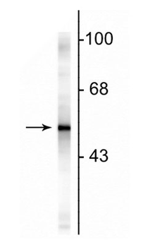 Glial Fibrillary Acidic Proetin (GFAP) Antibody