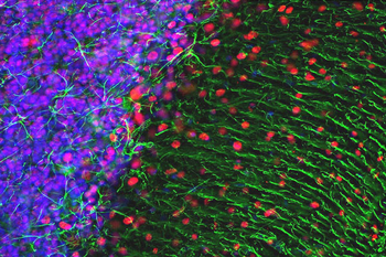 Glial Fibrillary Acidic Proetin (GFAP) Antibody