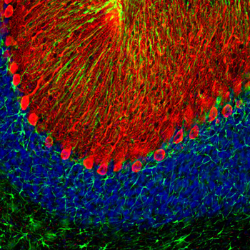 Glial Fibrillary Acidic Proetin (GFAP) Antibody