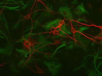 Glial Fibrillary Acidic Proetin (GFAP) Antibody