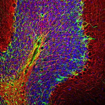 Glial Fibrillary Acidic Proetin (GFAP) Antibody