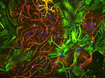 Glial Fibrillary Acidic Proetin (GFAP) Antibody
