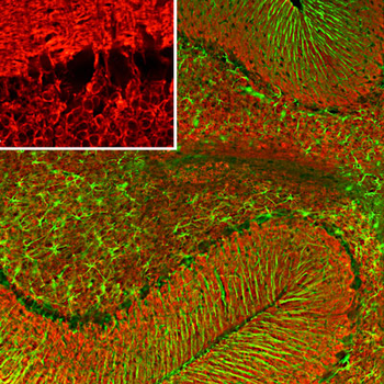 Glial Fibrillary Acidic Proetin (GFAP) Antibody