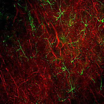 Neurofilament NF-L Antibody