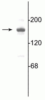 NMDA NR2A Subunit Antibody