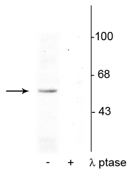 p53 (Ser392) Antibody