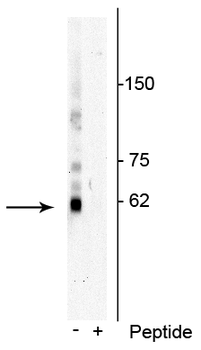 p62 (Thr269, Ser272) Antibody