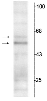 Thyroid Hormone Receptor, α1/α2-Isotype Antibody