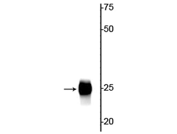 Troponin I (cardiac) Antibody