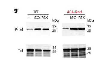 Troponin I (cardiac) Antibody