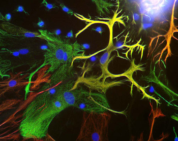 Vimentin Antibody