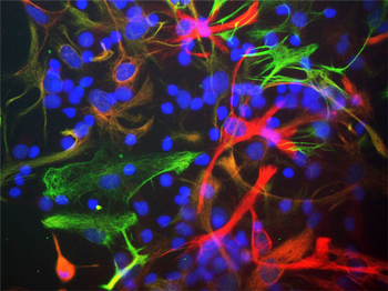 Vimentin Antibody
