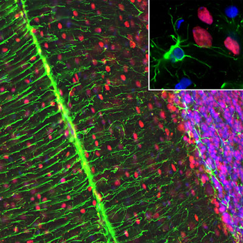 MeCP2 Antibody