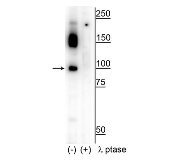 CtIP (Ser326) Antibody