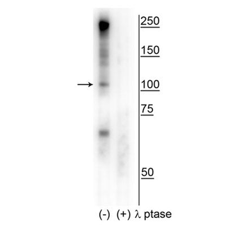 CtIP (Ser327) Antibody