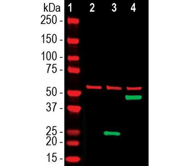 SARS-CoV-2 S-Protein ACE2 Binding Domain Antibody