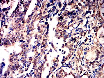 RUNX2 Rabbit Polyclonal Antibody