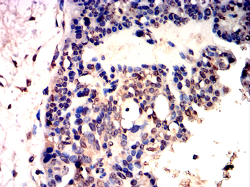 RUNX2 Rabbit Polyclonal Antibody