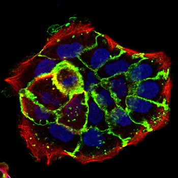 EGFR Antibody