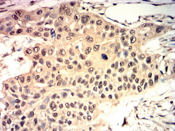 ATF3 Antibody