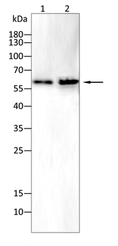AQP7 Rabbit Polyclonal Antibody