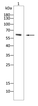 AQP7 Rabbit Polyclonal Antibody