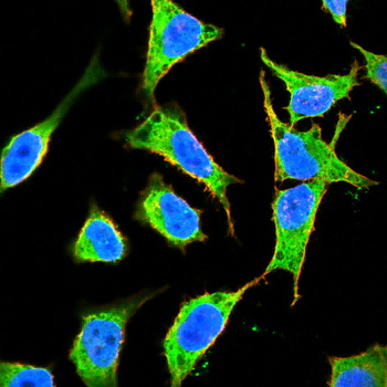 Myoglobin Rabbit Polyclonal Antibody