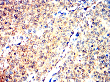 HIF-1 beta Rabbit Polyclonal Antibody