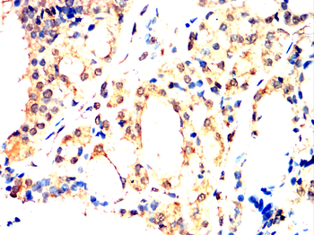 HIF-1 beta Rabbit Polyclonal Antibody