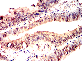 FUBP3 Antibody