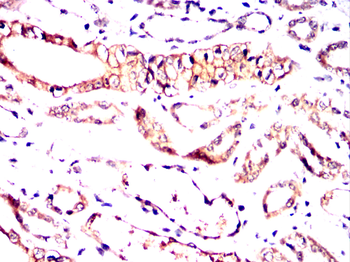 MAP3K5 Antibody