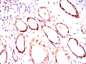 MAP3K5 Antibody