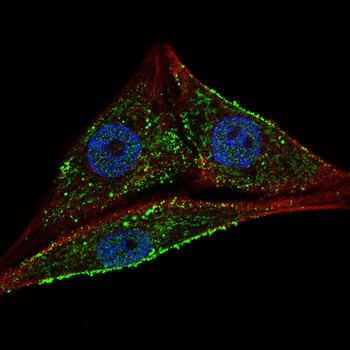 HMGCR Rabbit Polyclonal Antibody
