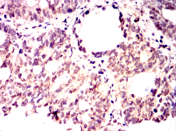 HMGCR Rabbit Polyclonal Antibody