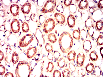 HMGCR Rabbit Polyclonal Antibody