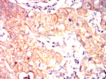 HMGCR Rabbit Polyclonal Antibody