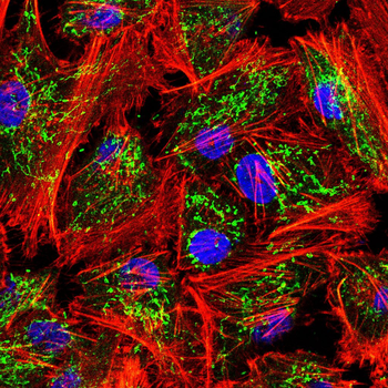 CD206 Rabbit Polyclonal Antibody