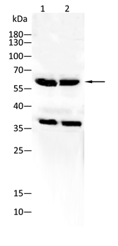 ESR2 Rabbit Polyclonal Antibody