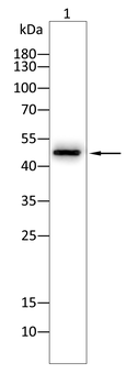 WT1 Antibody