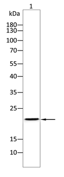 TNNI2 Antibody