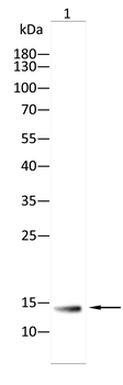 B2M Rabbit Polyclonal Antibody