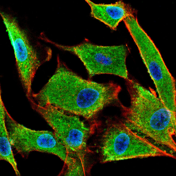 ESRRA Rabbit Polyclonal Antibody