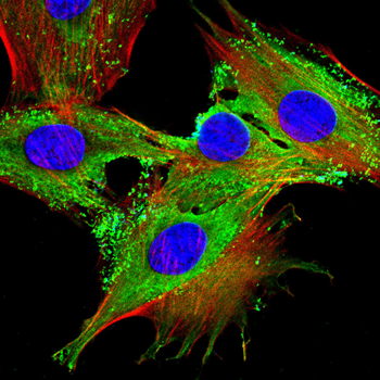 KGF Rabbit Polyclonal Antibody