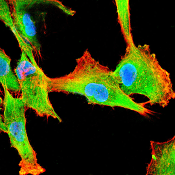 KGF Rabbit Polyclonal Antibody